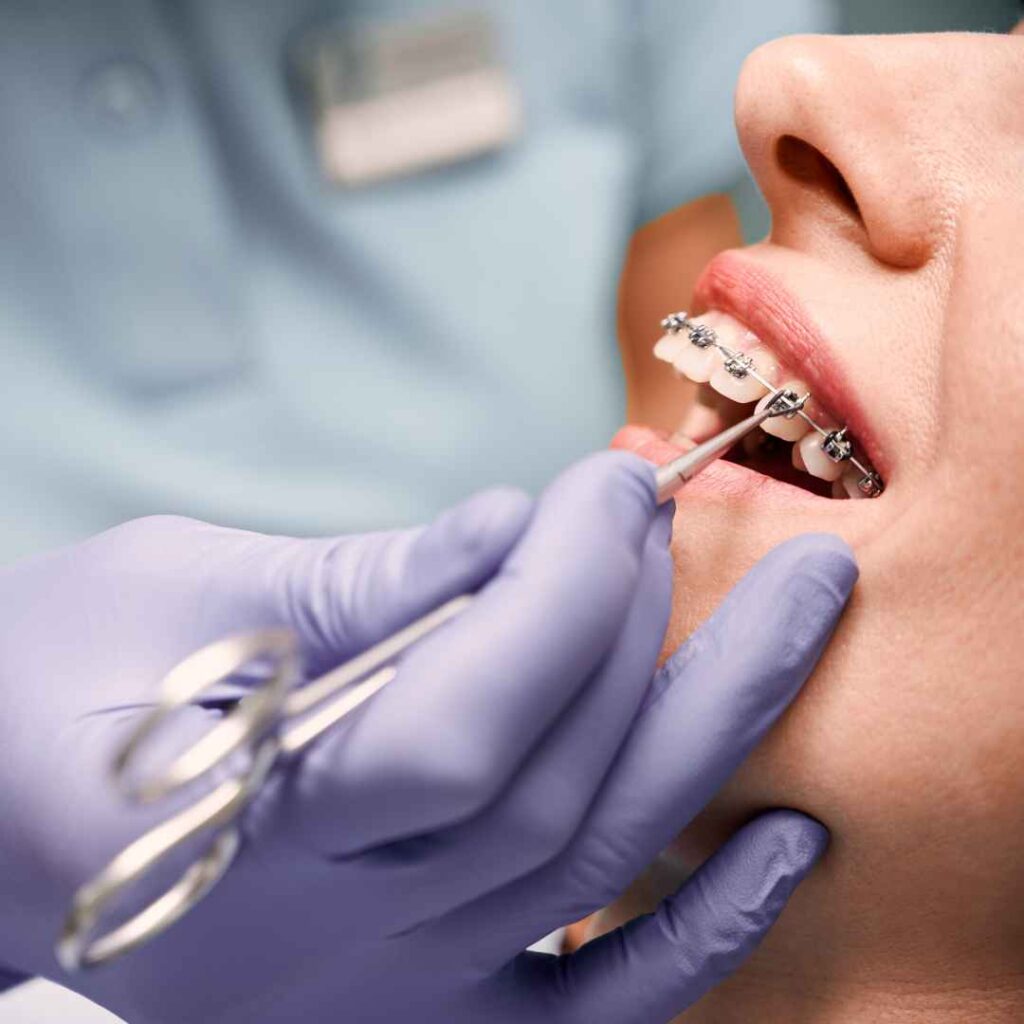 Cosmetic Dentist in Thane 18 Advanced Orthodontic Treatments in Thane