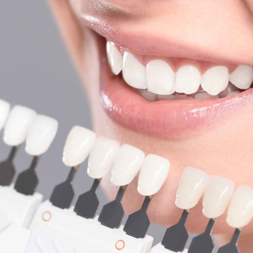 Artificial Tooth Selection