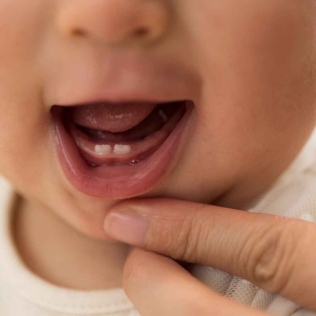 Baby Tooth Extractions in Thane