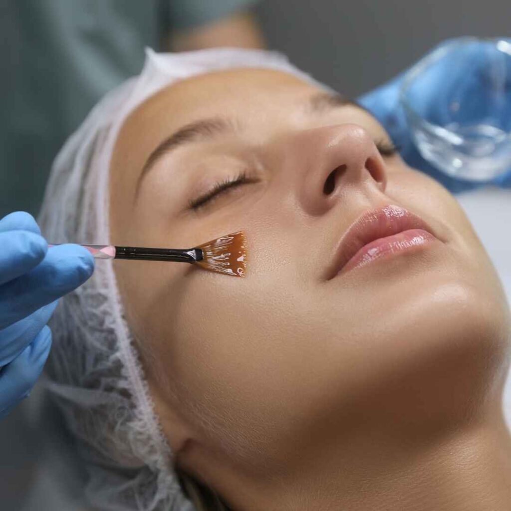 Chemical Peels for Wart Removal in Thane