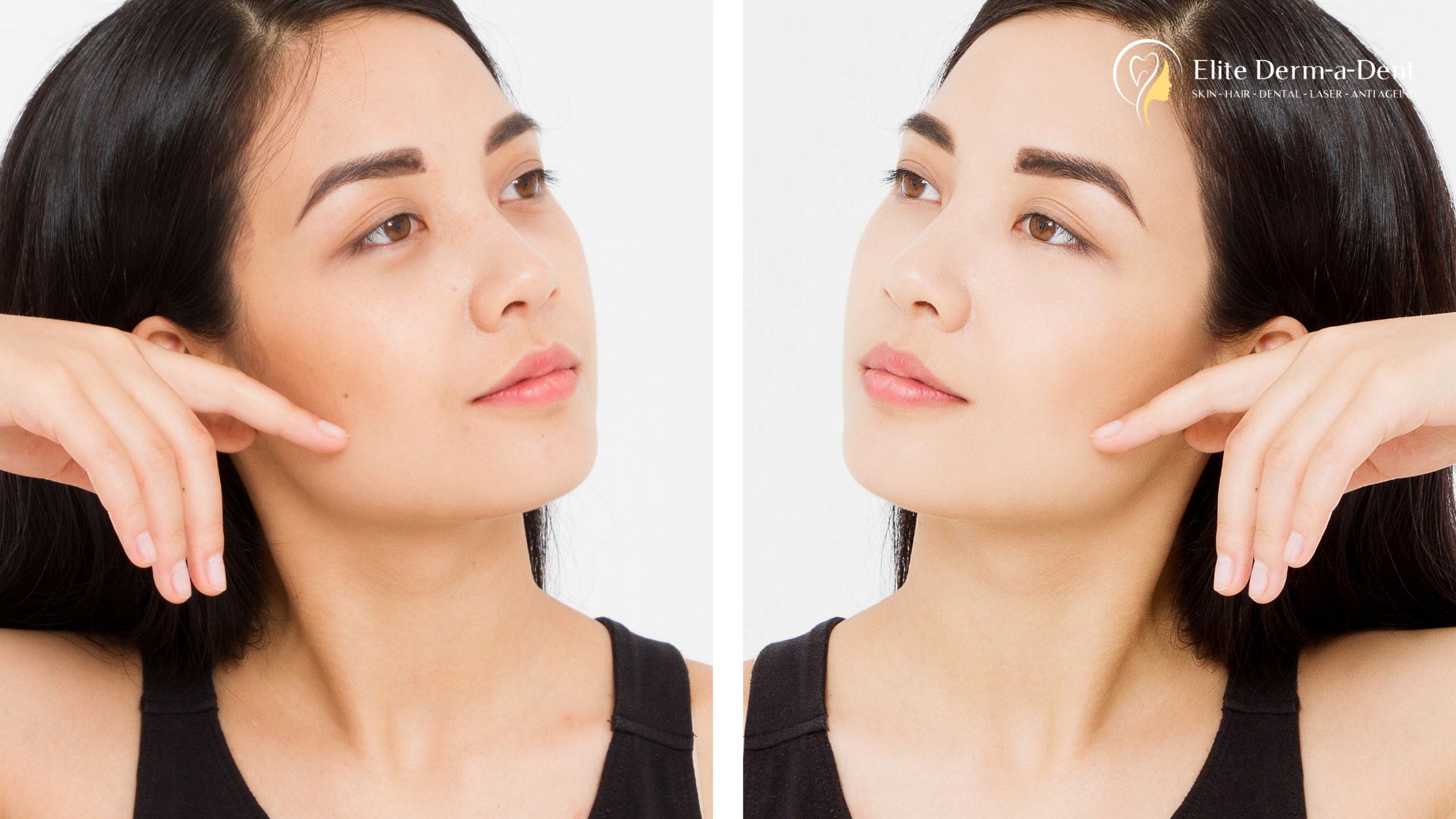 Dark Circle Treatment in Thane 1 Dark Circle Treatment in Thane
