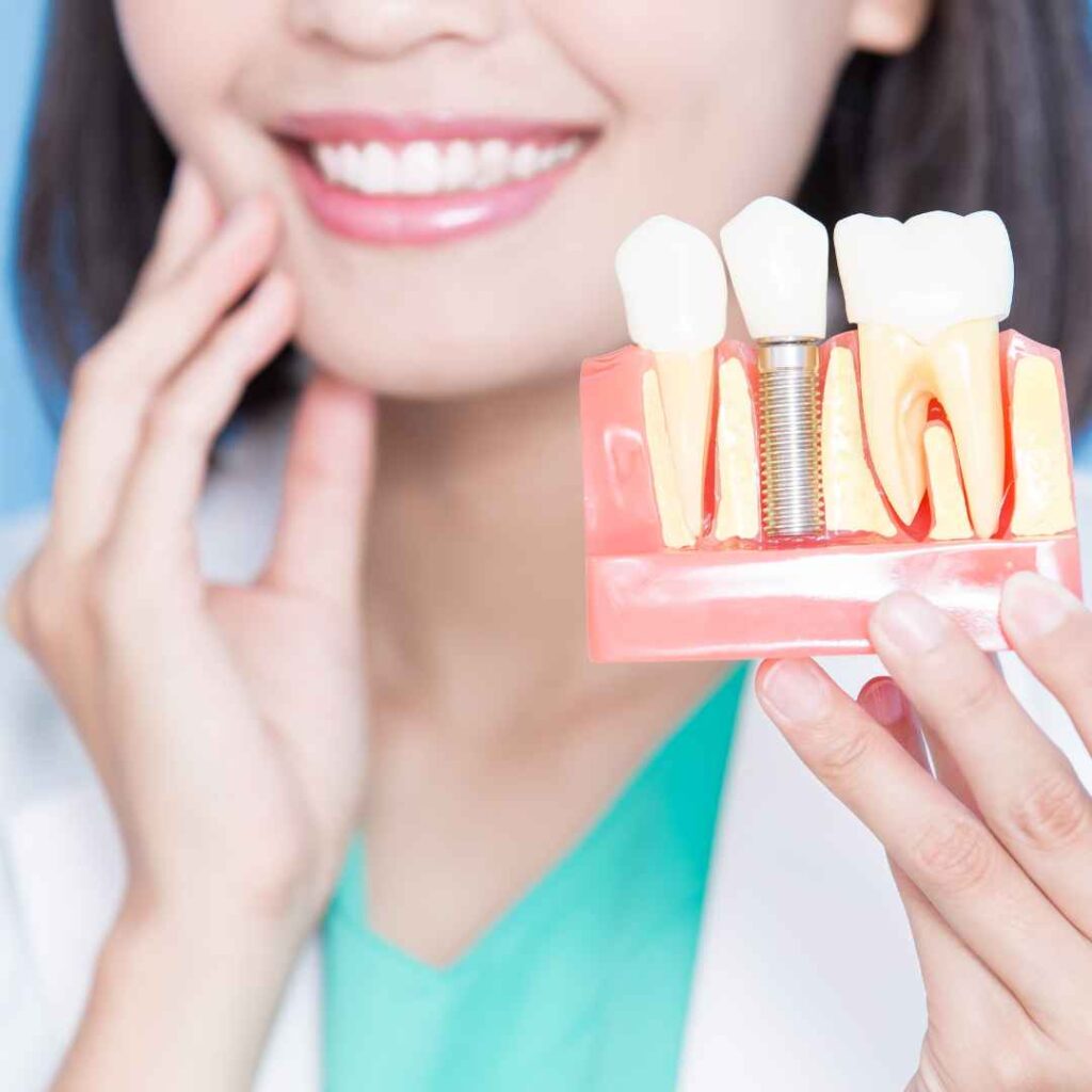 Cosmetic Dentist in Thane 9 Dental Implants in Thane
