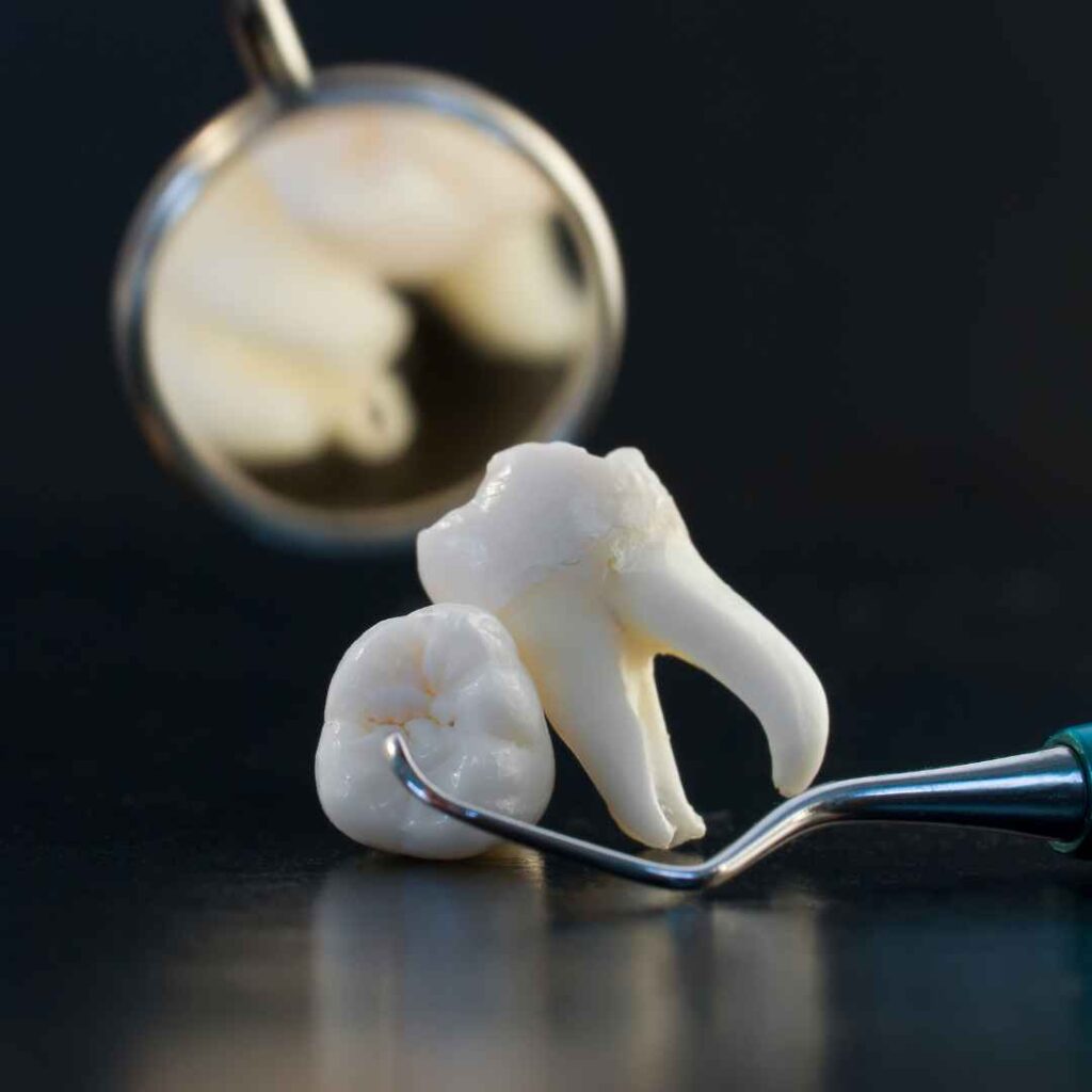 Diagnosis of Dental Pulp Diseases