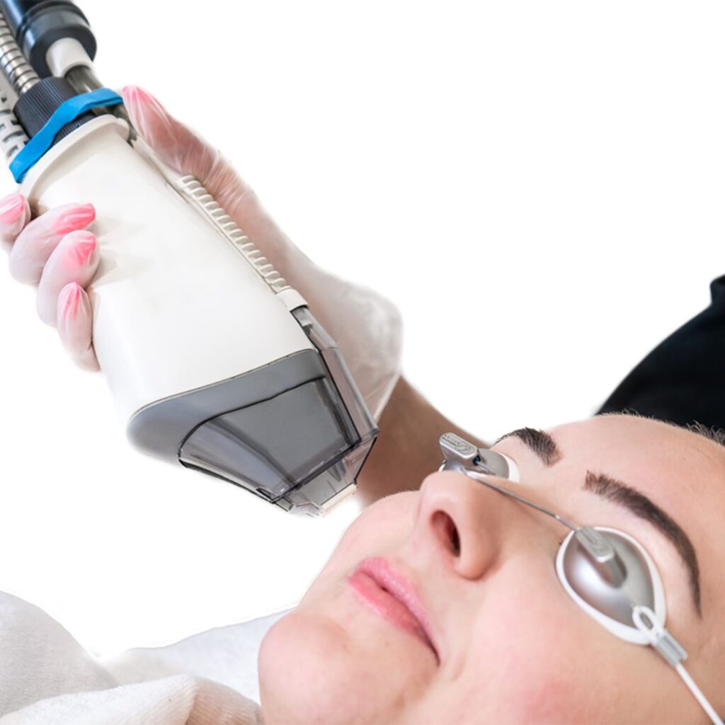 Dark Circle Treatment in Thane 18 Fraxel® DUAL Laser Treatment