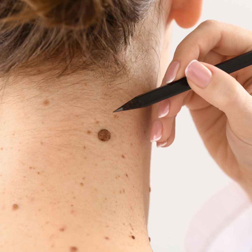 High-Frequency Current Treatment in Thane