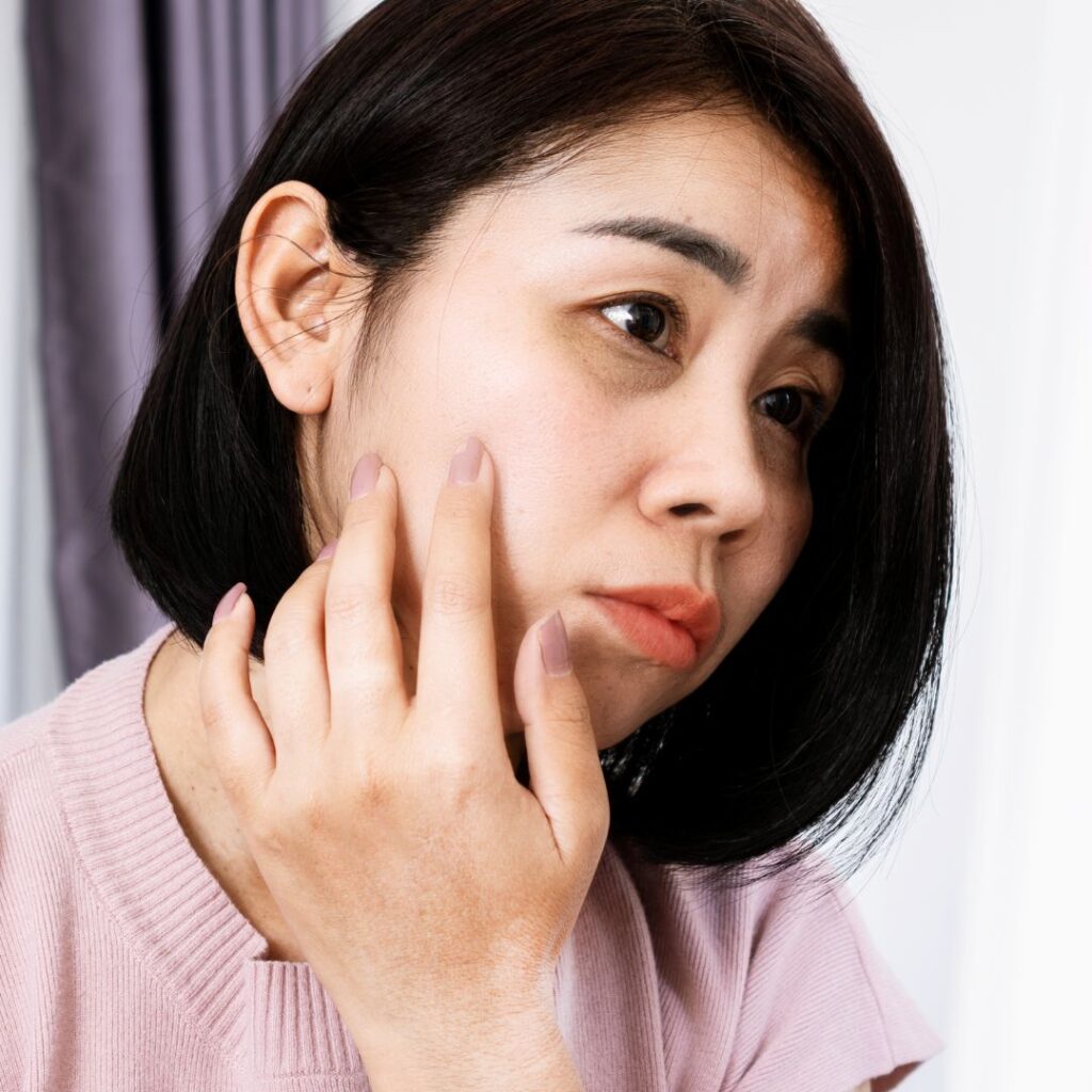 Dark Circle Treatment in Thane 2 Introduction to Dark Circle Treatment in Thane