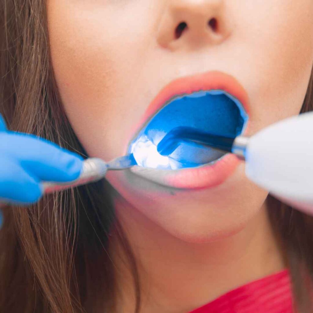 Cosmetic Dentist in Thane 12 Laser Dentistry