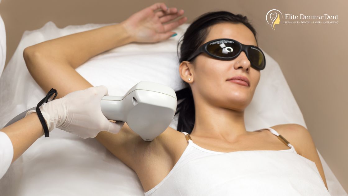 Laser Hair Removal in Thane