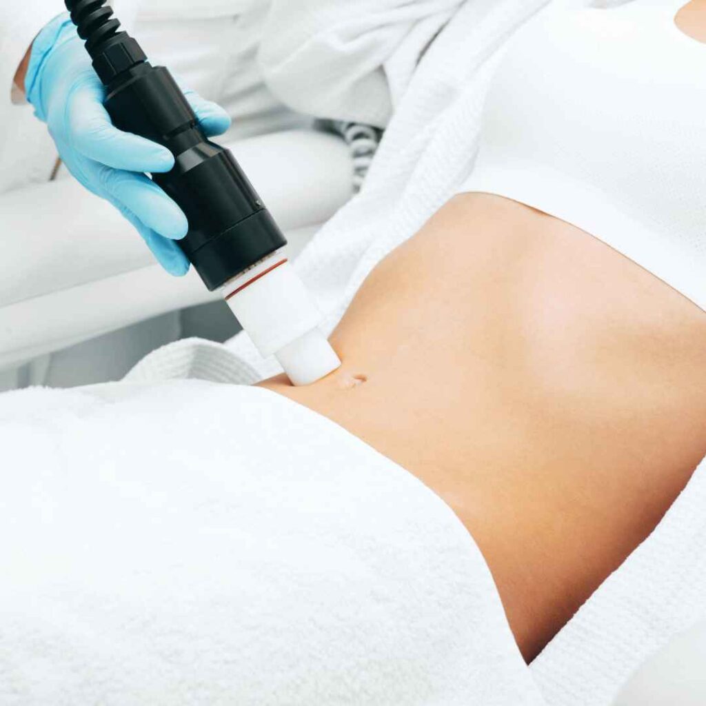 Stretch Marks Treatment in Thane 4 Laser Therapy for Stretch Marks