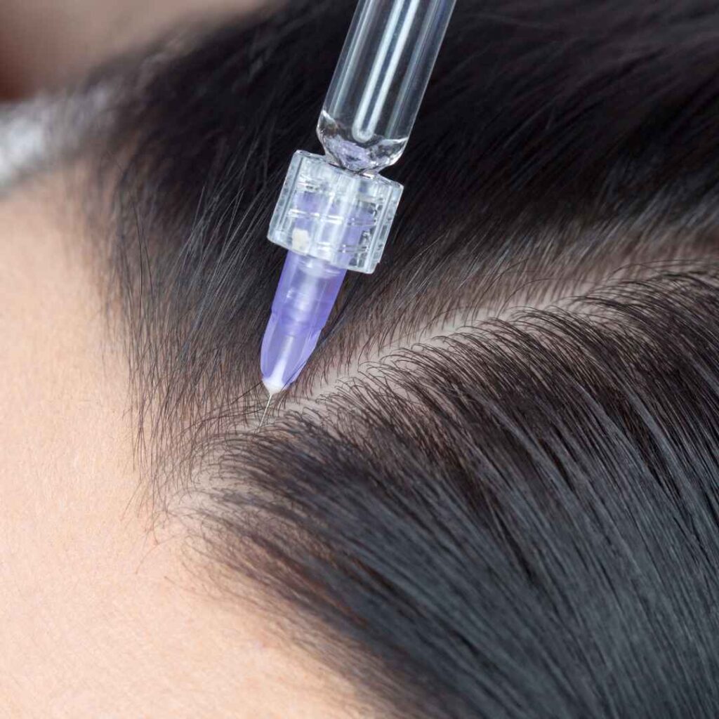 Mesotherapy