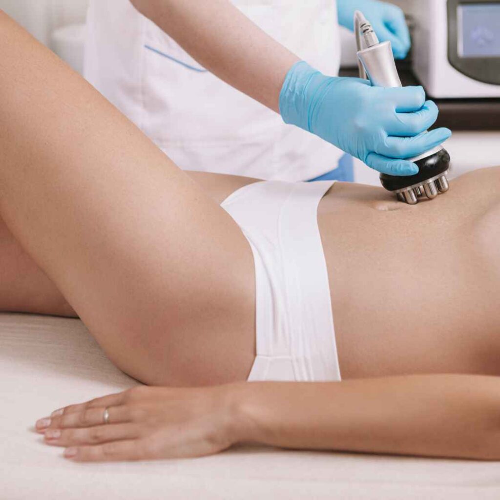 Stretch Marks Treatment in Thane 17 Non-Surgical Skin Tightening for Stretch Marks