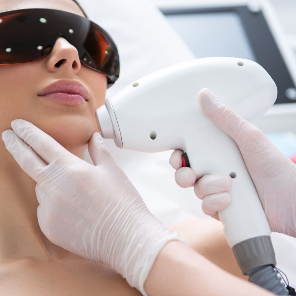 Dark Circle Treatment in Thane 22 Q-Switch Lasers & Pulsed Dye Lasers