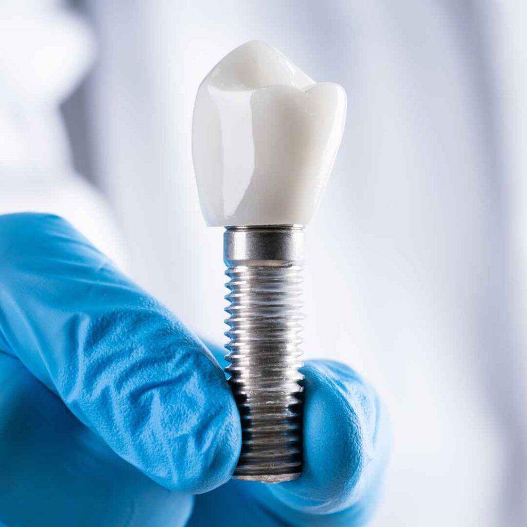 Single Tooth Implant in Thane