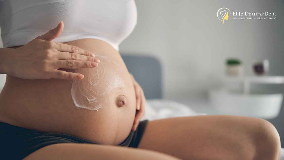 Stretch Marks Treatment in Thane 1 Stretch Marks Treatment in Thane