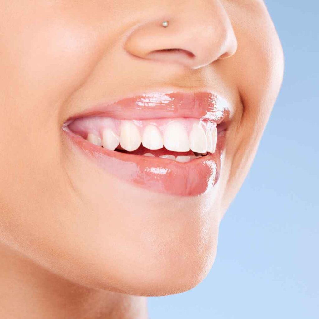 Cosmetic Dentist in Thane 4 Teeth Whitening in Thane