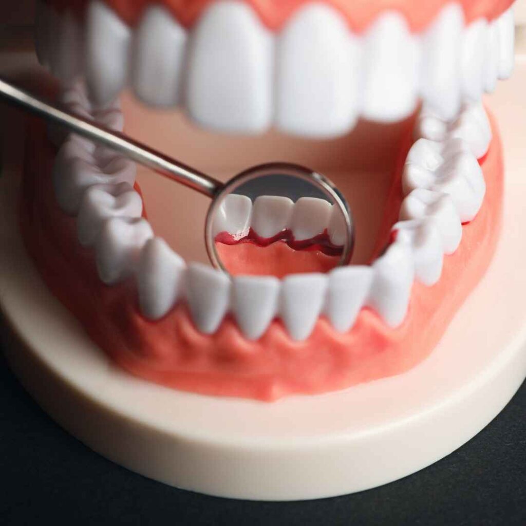 Cosmetic Dentist in Thane 10 Tooth and Gum Contouring in Thane
