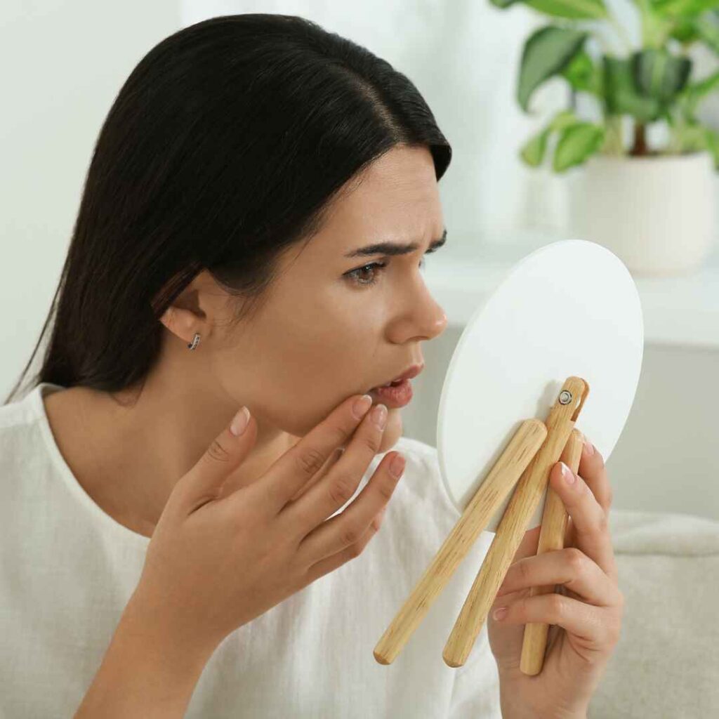 Hormonal Acne Treatment in Thane