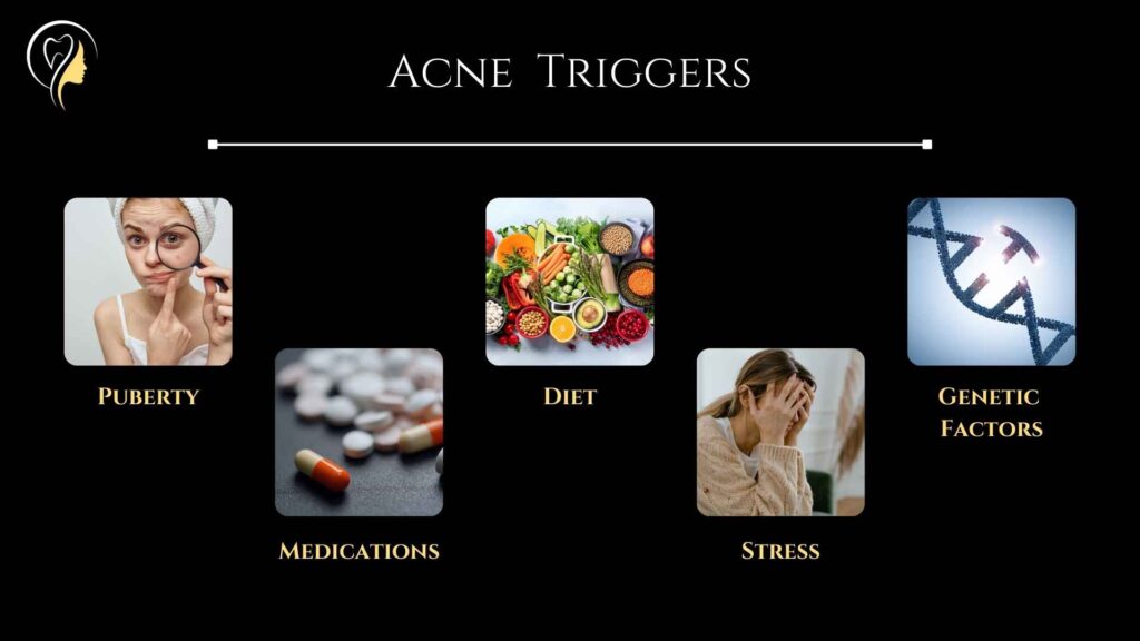 Diet and Acne (2024) | Dr. Arefa Patel 4 Diet and Acne - Acne Triggers