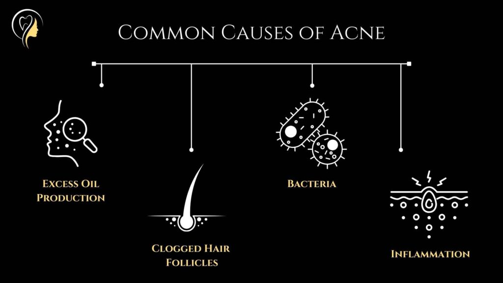 Diet and Acne (2024) | Dr. Arefa Patel 3 Diet and Acne: Common Causes of Acne