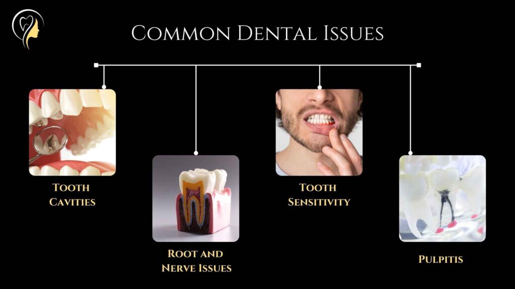 Common Dental Issues