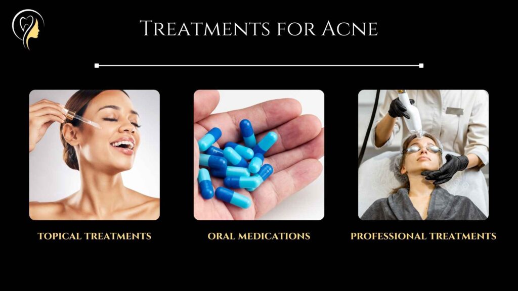 Types of Acne (2024) | Dr. Arefa Patel 5 Treatments for Acne, Topical Treamtnets, Oral Medications, Professional Treatments