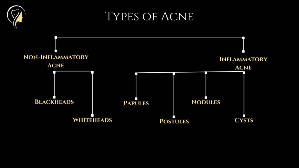 Diet and Acne (2024) | Dr. Arefa Patel 2 Types of Acne