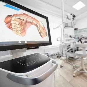 Smile Design in Thane (2024) 10 Advanced Technology for Smile Design