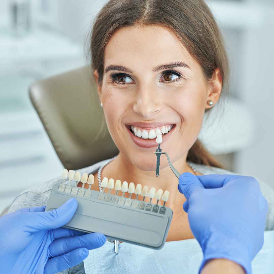 Bleaching Gels and Trays