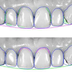 Smile Design in Thane (2024) 6 Digital Smile Design Software