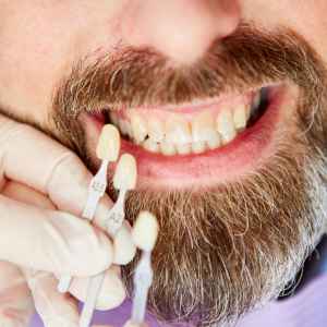 Tooth Discoloration