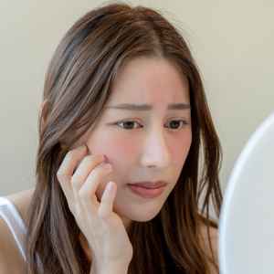 Dull Skin