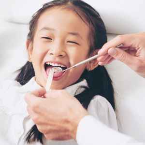 Glass Ionomer Tooth Filling