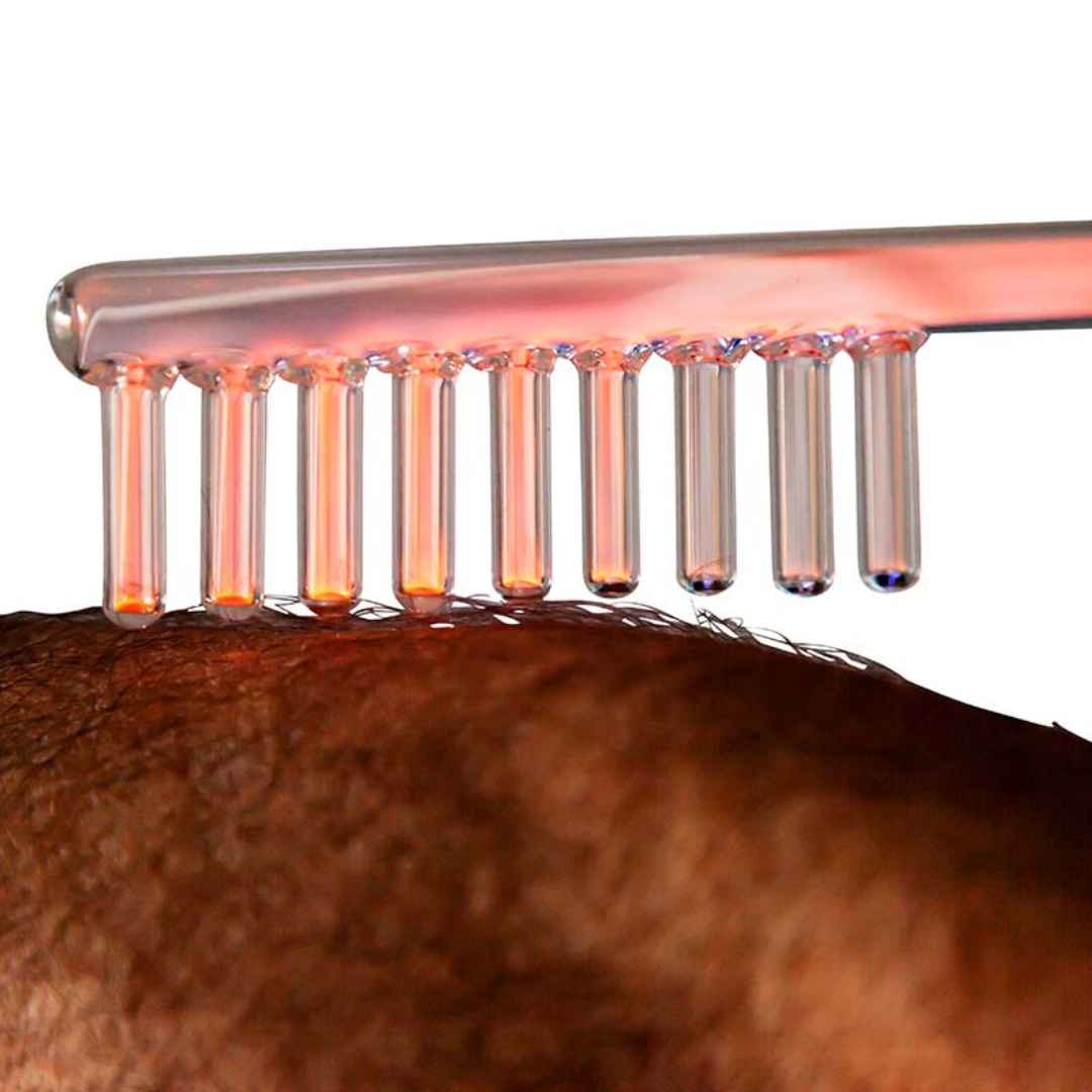 Laser-assisted Hair Growth Therapies