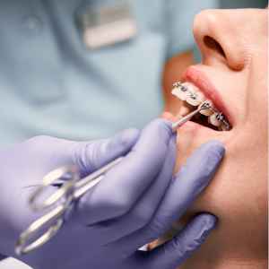 Smile Design in Thane (2024) 3 Orthodontics