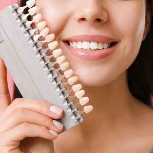 Smile Design in Thane (2024) 4 Porcelain Veneers