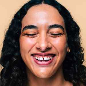 Smile Design in Thane (2024) 13 Remove Dental Imperfections with Smile Design