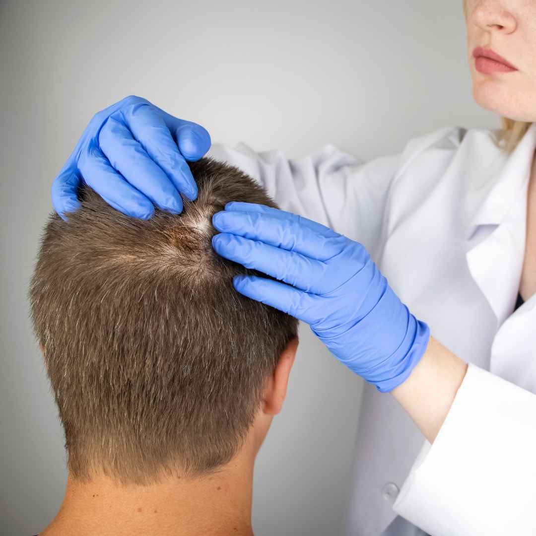 Scalp Micropigmentation in Thane