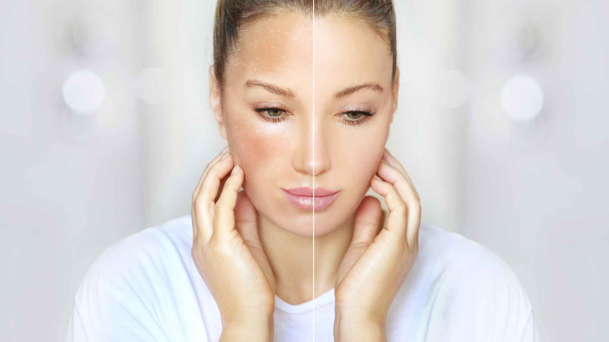 Skin Whitening Treatment in Thane