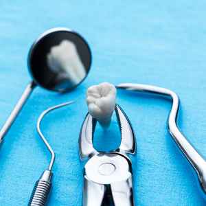 Tooth Extraction in Thane (2024) 3 Surgical Tooth Extractions