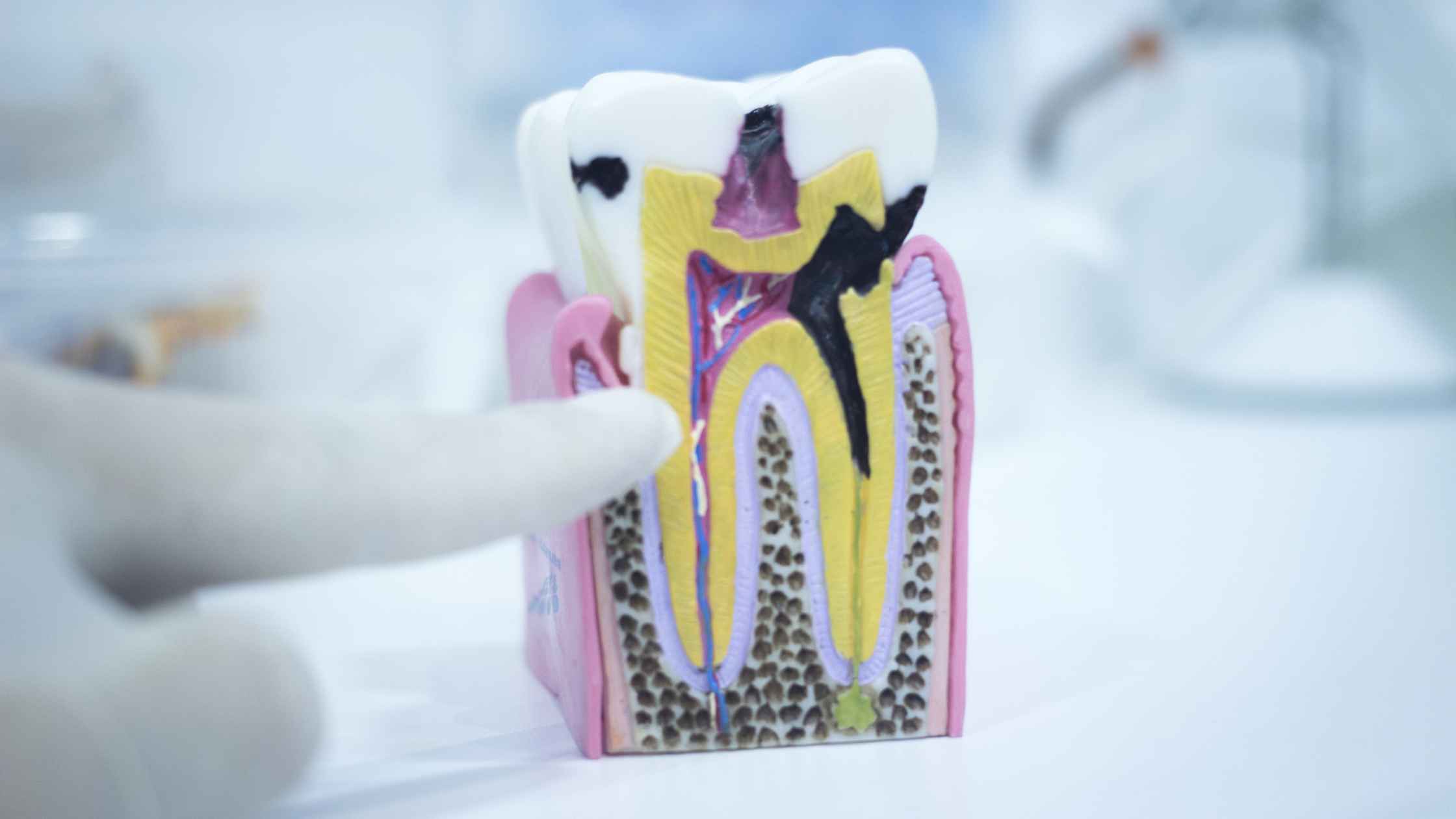 Tooth Filling in Thane