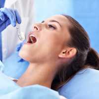 Best Family Dentist in Rabodi, Thane 4 Root Canal