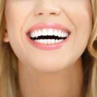 Best Family Dentist in Rabodi, Thane 9 Smile Design