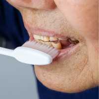 Best Family Dentist in Rabodi, Thane 14 Tooth Erosion