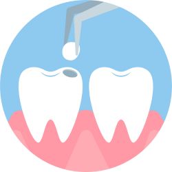 Dr. Saurabh Pakhale 2 Dental Fillings