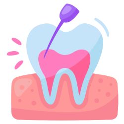 Dr. Saurabh Pakhale 4 Root Canal Treatments