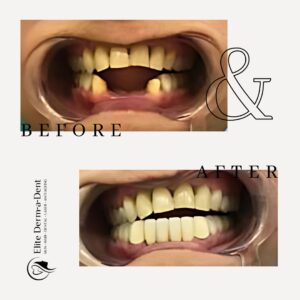 Dental Before and After 3