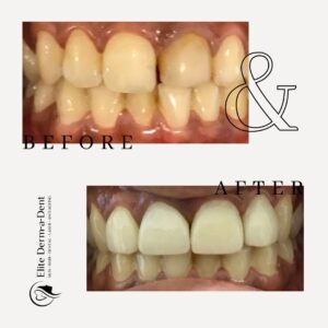 Dental Before and After 4