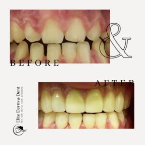 Dental Before and After 5