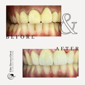 Dental Before and After 7