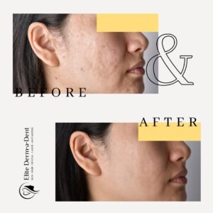 Skin Transformations 1